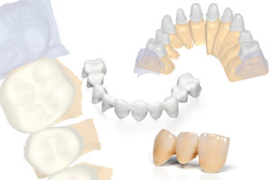 Tecnica CAD CAM: protesi dentale