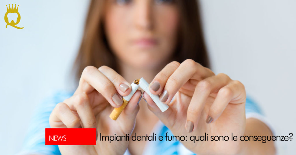 Impianti dentali e fumo | Dental Q