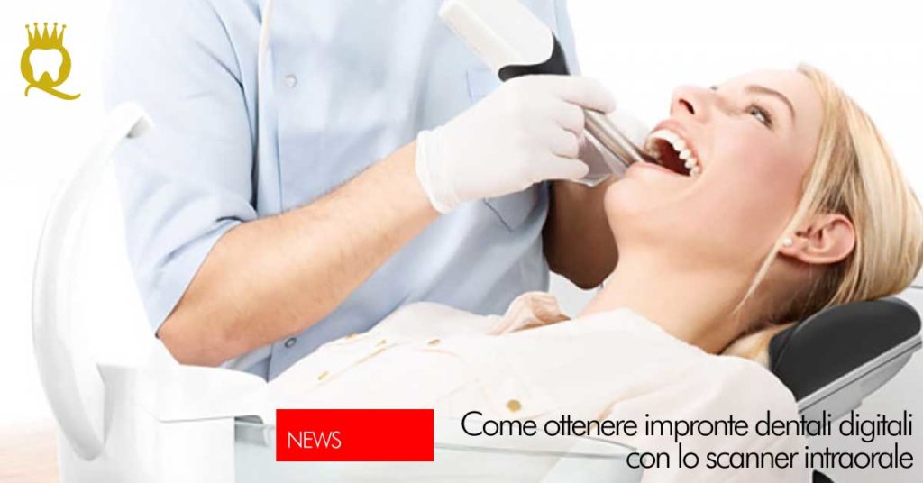 Impronte dentali digitali con lo scanner intraorale | DentalQ