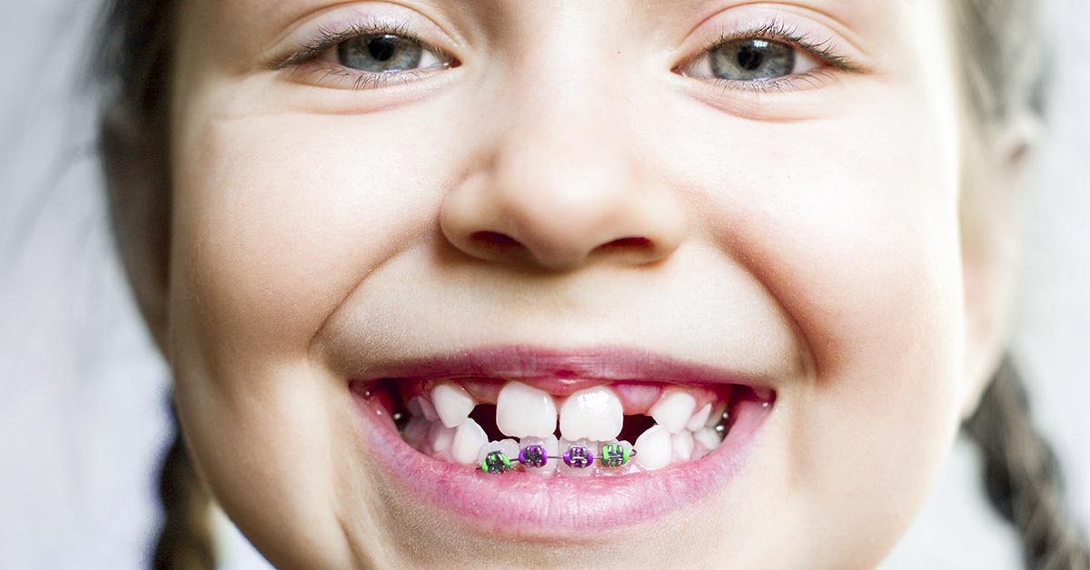 Odontoiatria per bambini | Odontoiatria Q