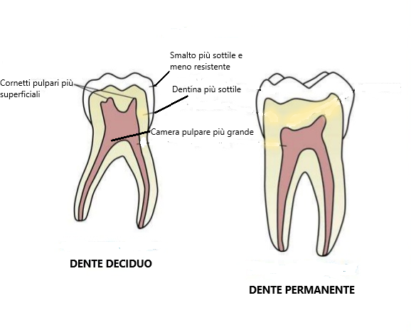 carie nei denti da latte: struttura denti